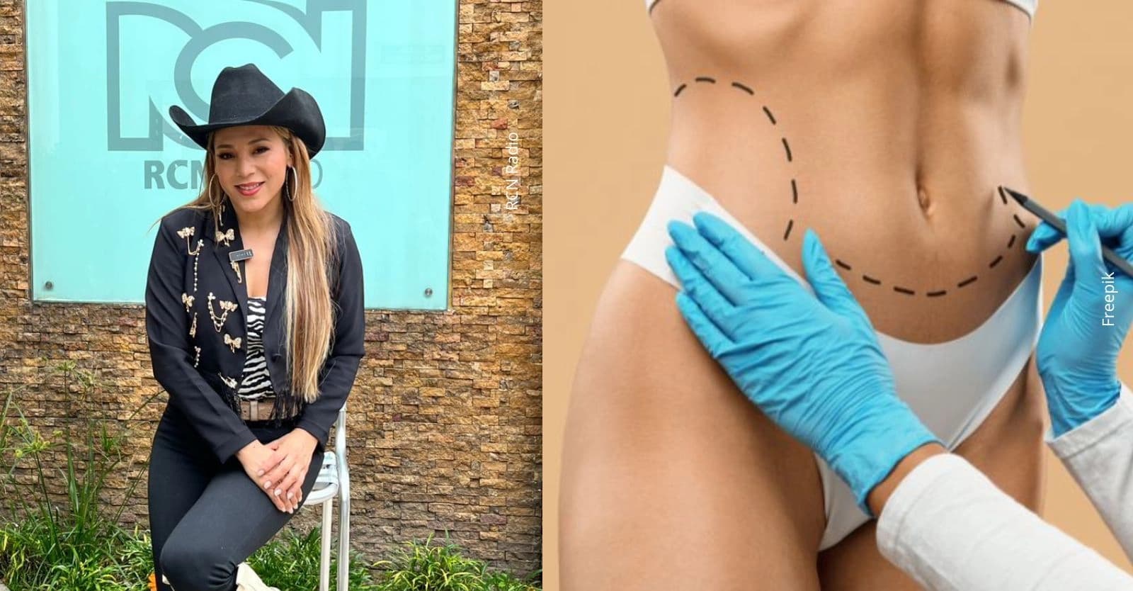 ¿Cuál fue el extremado procedimiento quirúrgico al que se sometió Adriana Bottina?