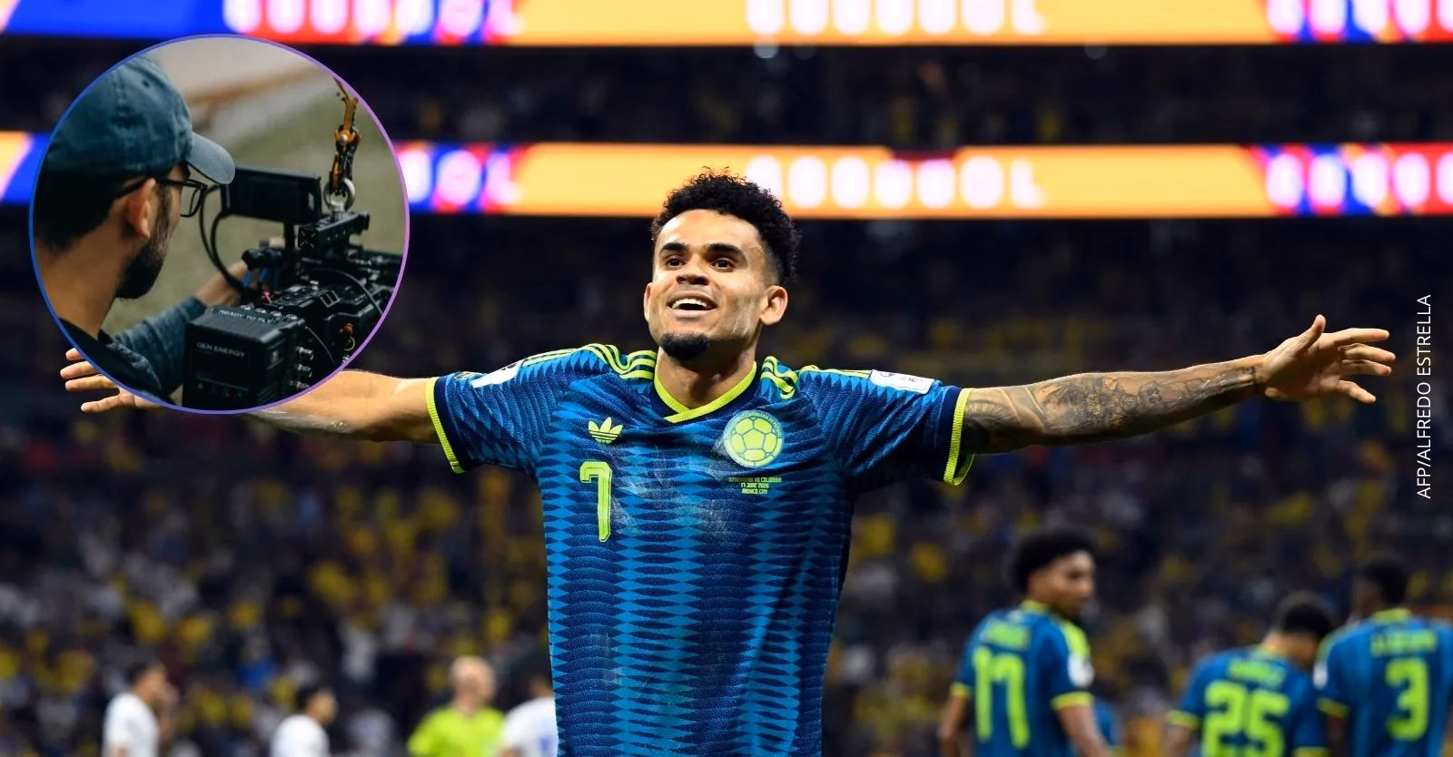 Mundial 2026: ¿Qué sucedió con el camarógrafo que resultó herido durante el partido entre Colombia vs. Uzbekistán?