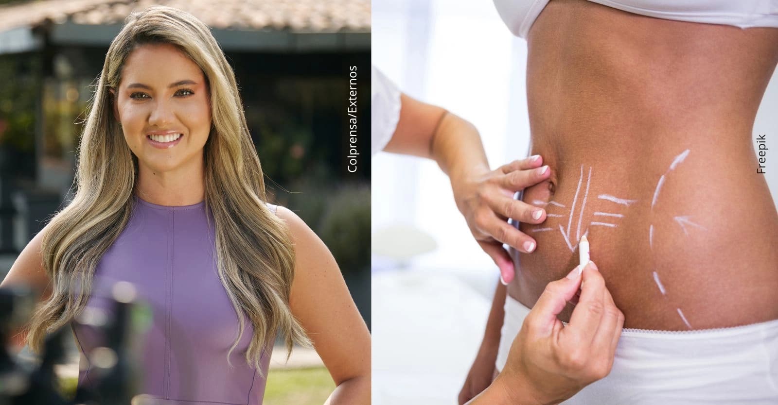 Daniella Álvarez revela los resultados del retoque estético al que se sometió: ¿Cómo quedó?