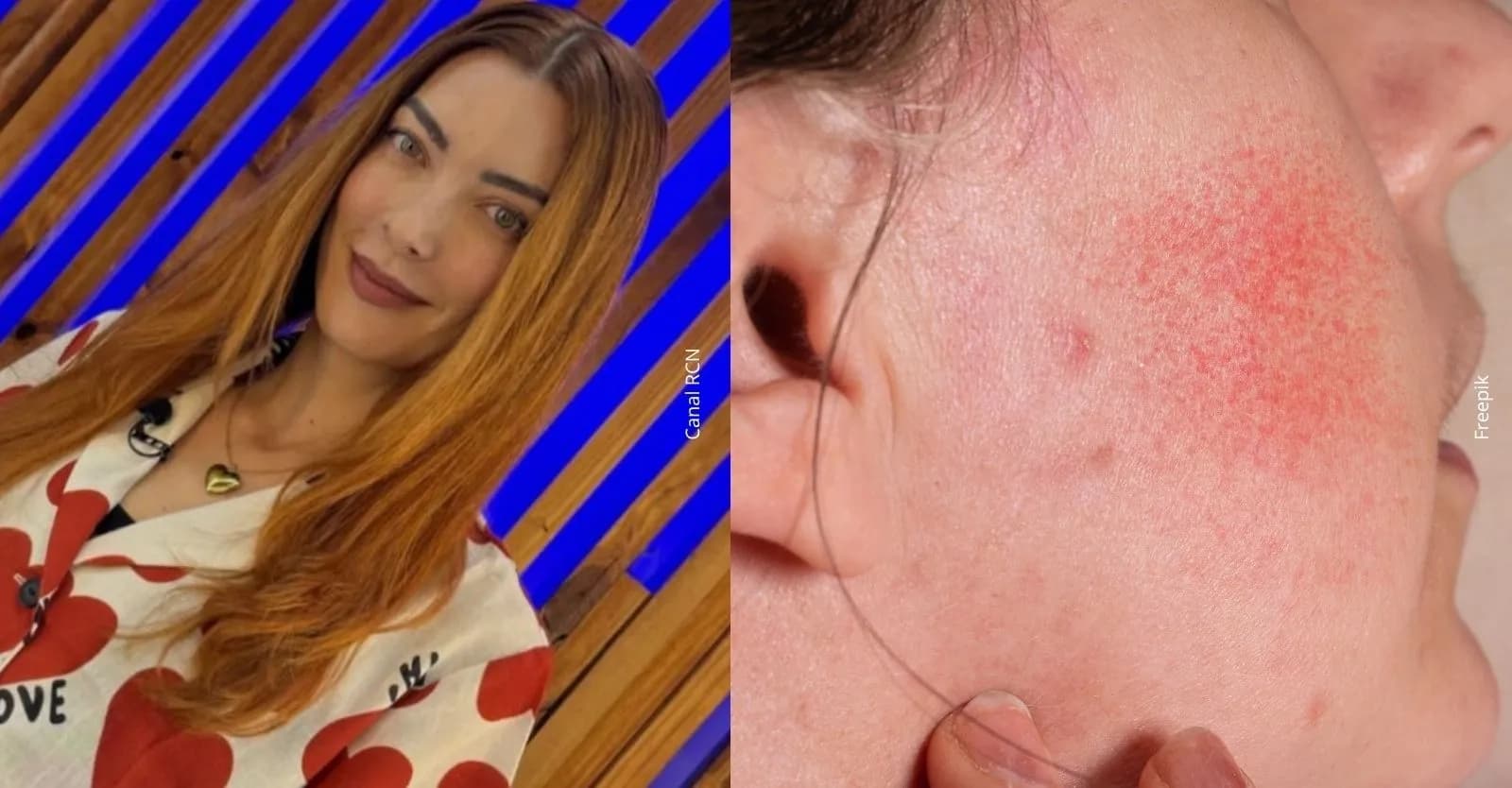 Norma Nivia revela afectaciones en su rostro: ¿qué le pasó y por qué preocupó a sus seguidores?